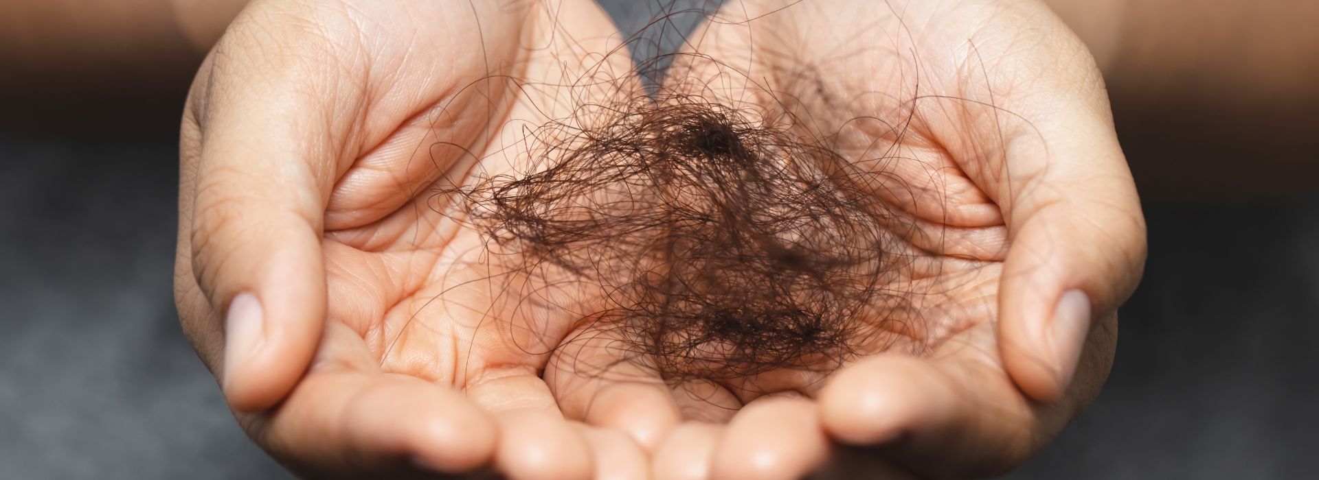 ¿Caída de pelo en verano? Descubre lo ultimo en análisis capilar